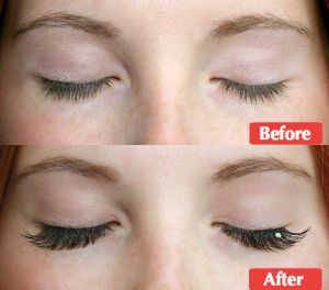 misencil ferme avant apres 2