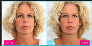 Screen Shot 2017 05 25 at 08.18.45