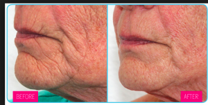 Screen Shot 2017 05 25 at 08.24.02