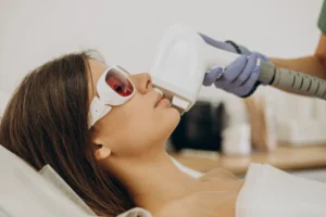 8 Reasons to consider IPL laser treatment