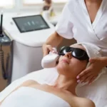 IPL Treatments ASPA