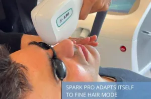 Laser hair removal Den Haag