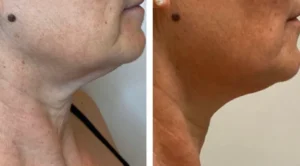 The T-Shape multisystem